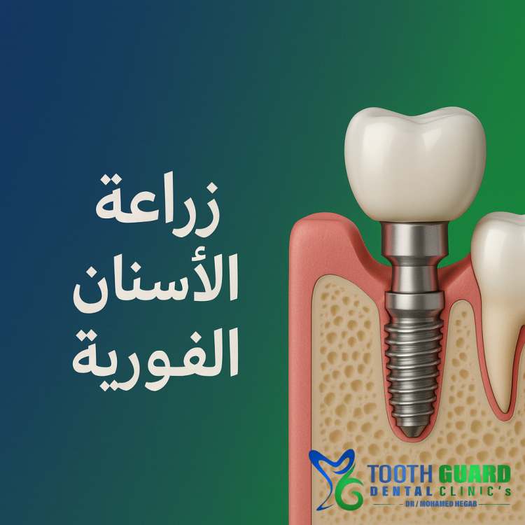 صورة مقالة